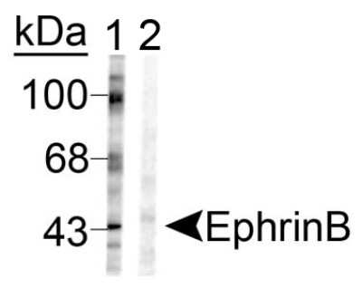 Western Blot: Ephrin-B1 [p Tyr317] Antibody [NB300-275]